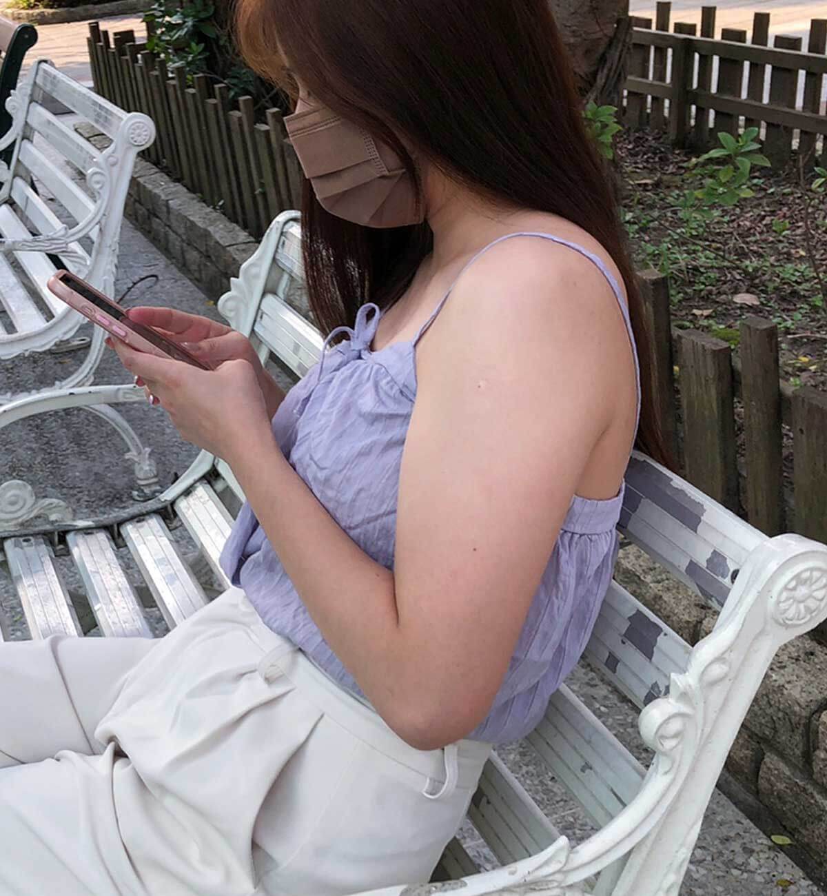 手臂抽脂手術_術前案例