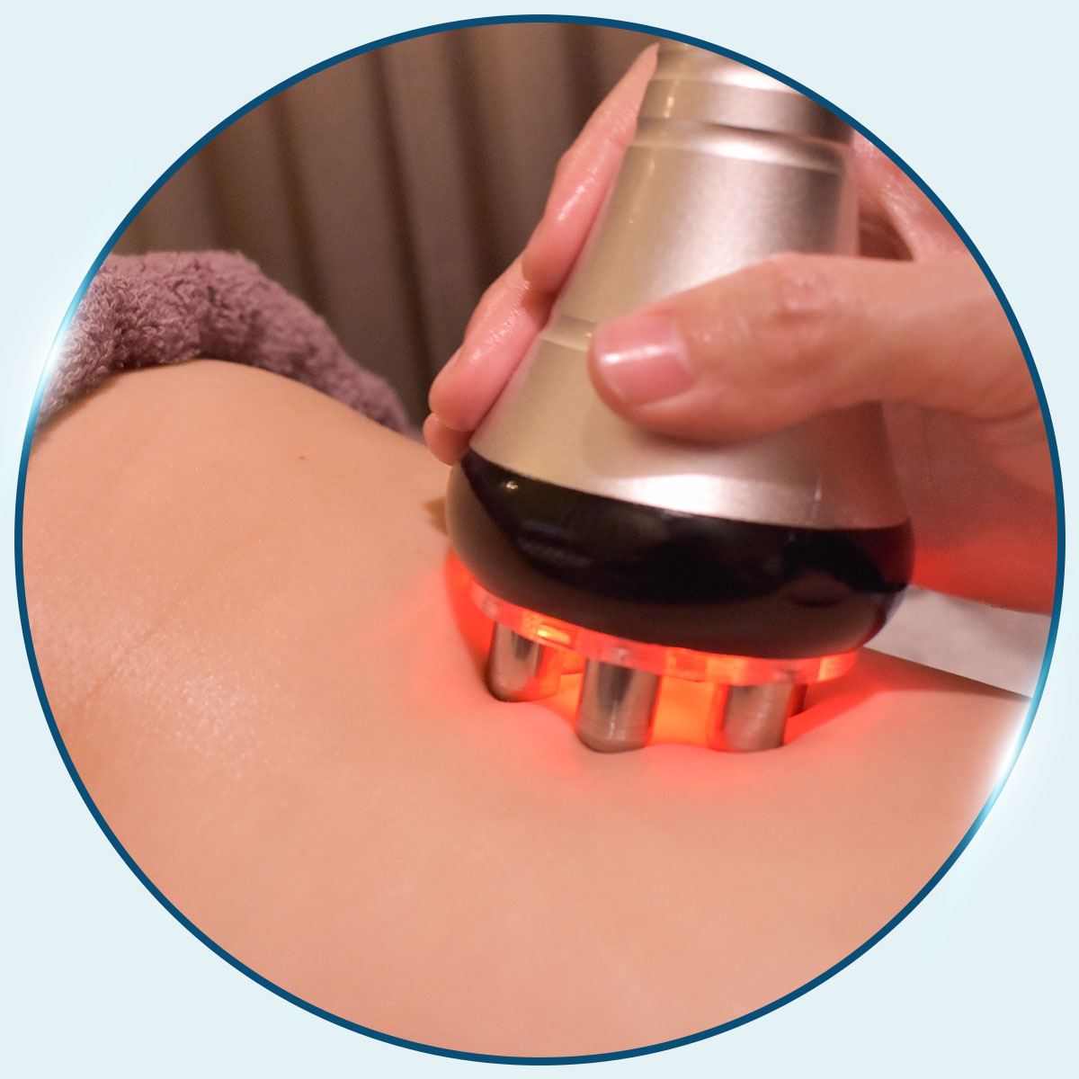 抽脂手術_RF電波