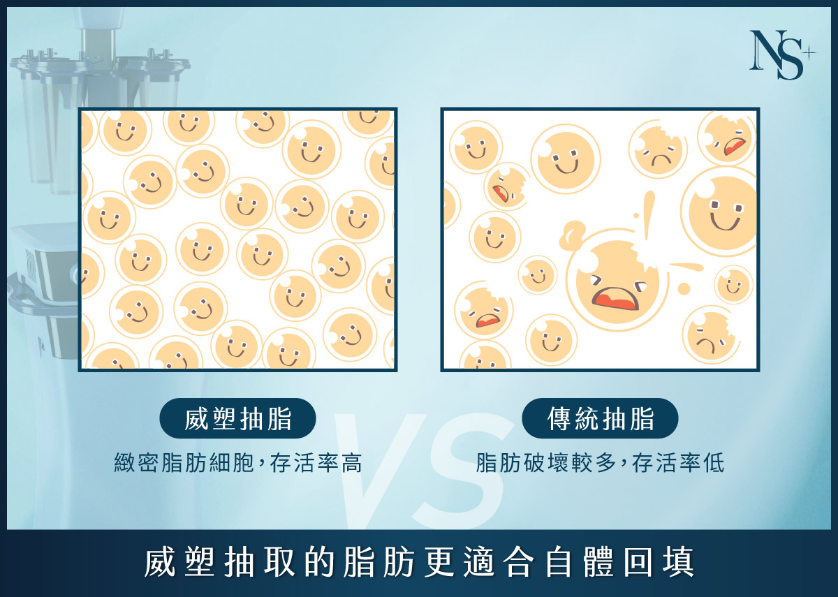威塑抽脂_脂肪純活率高
