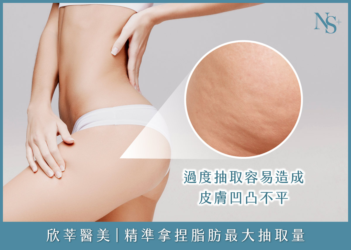 威塑抽脂_均勻移除脂肪，避免抽脂術後凹凸不平