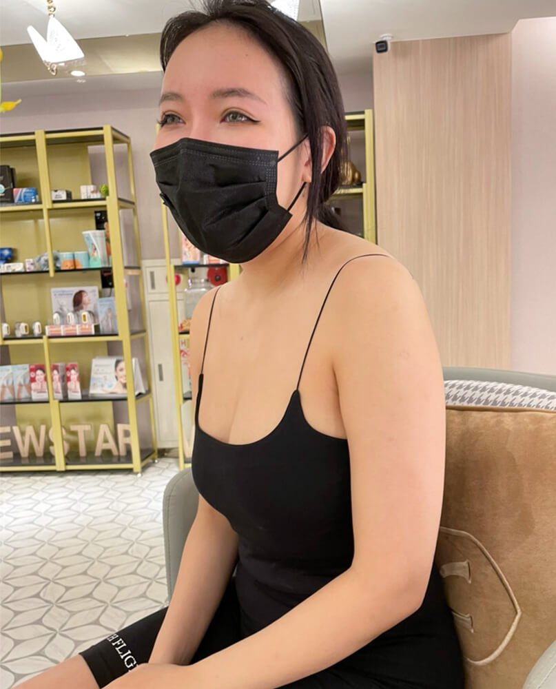 自體脂肪隆乳_術前