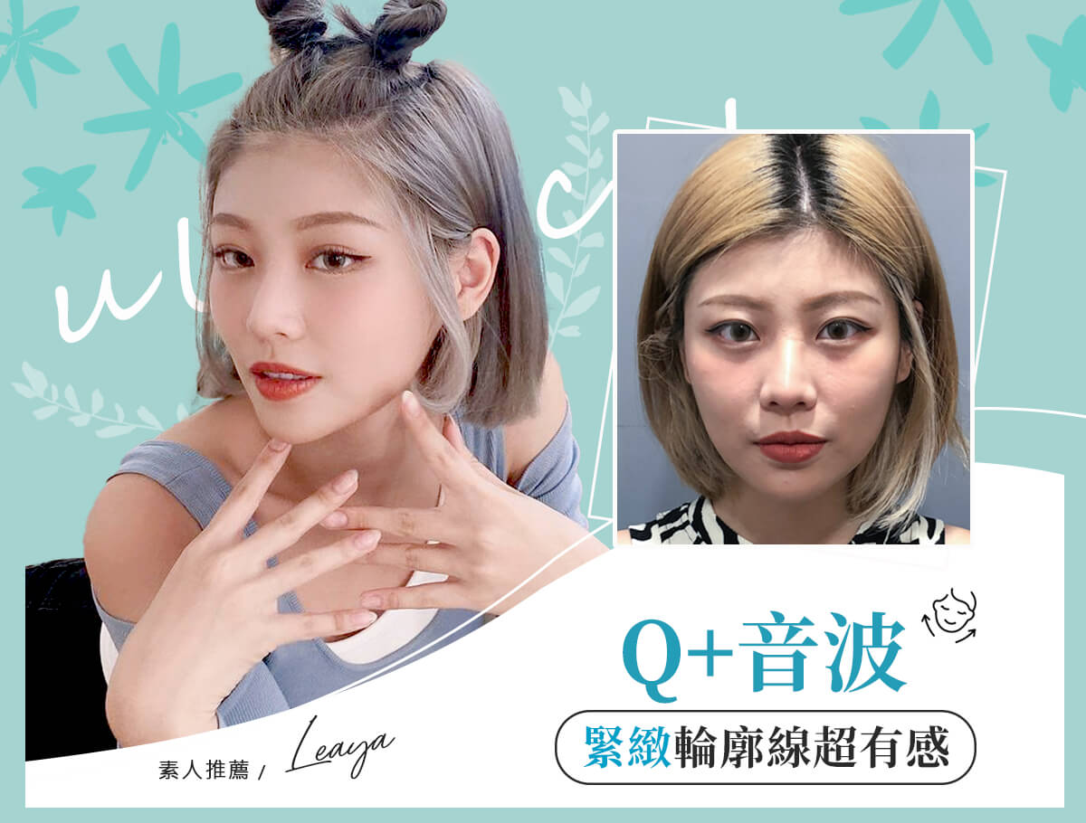 Q+音波_案例封面