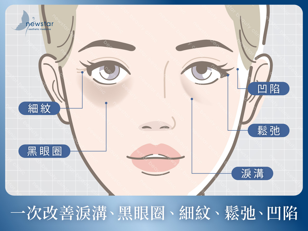 膠原蛋白熊貓針_五大優勢_眼周五大問題