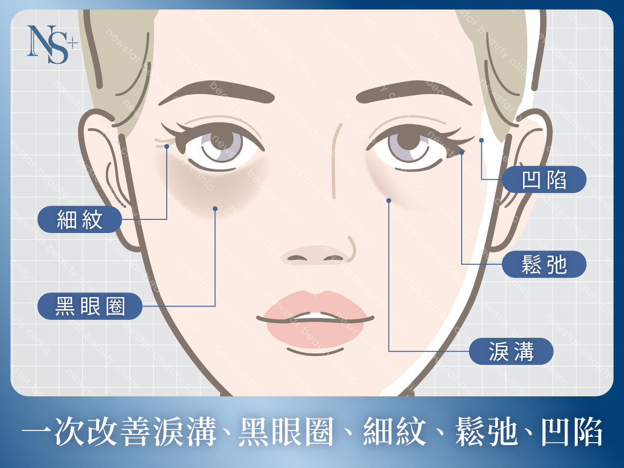 膠原蛋白熊貓針_五大優勢_眼周五大問題