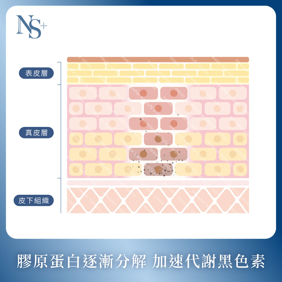 膠原蛋白熊貓針_亮白肌膚