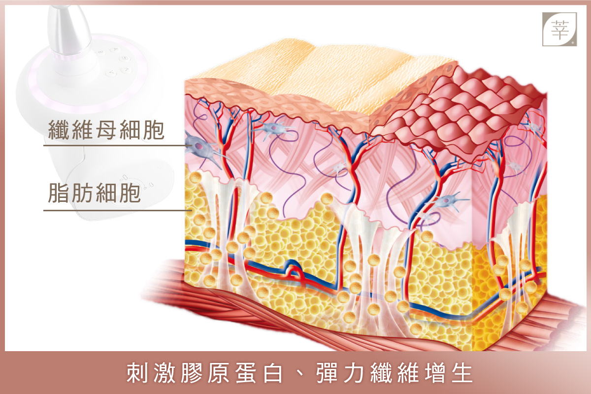 LPG優勢4_刺激膠原蛋白增生