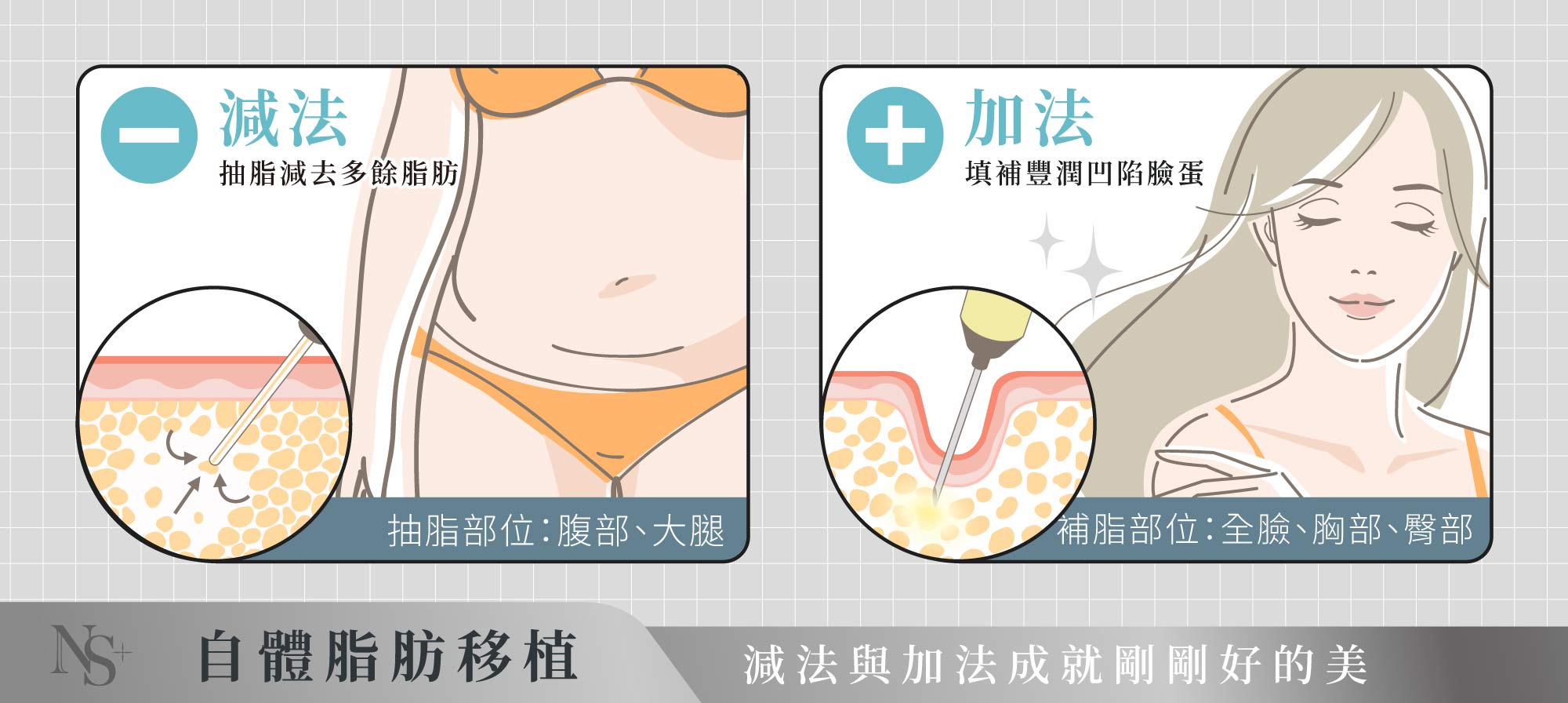自體脂肪補臉_自體脂肪轉移