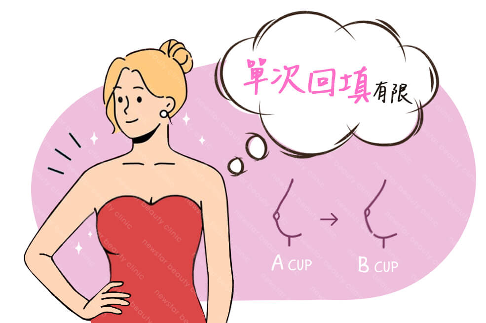 自體脂肪隆乳缺點：脂肪單次回填量有限