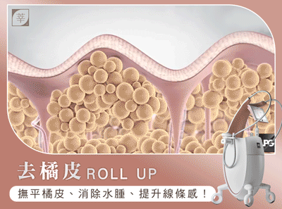 LPG_治療步驟