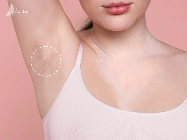 珍珠波 盈波隆乳_各個位置都隱痕
