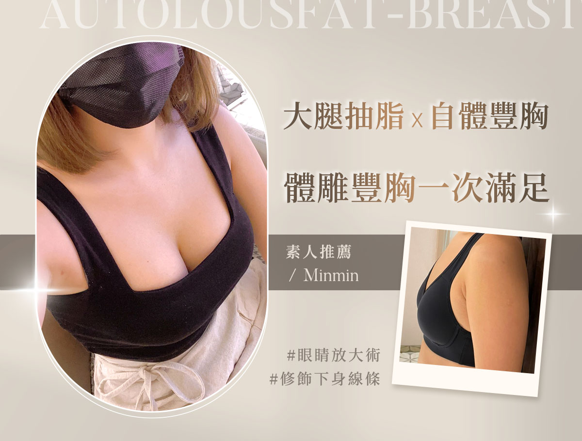 大腿抽脂 自體補胸_外bn_敏敏1