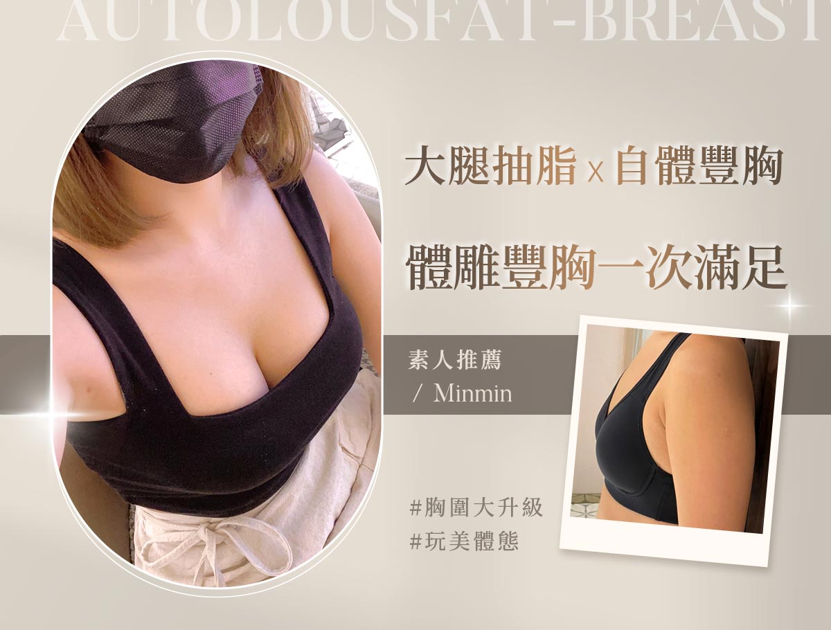 大腿抽脂-自體補胸_外bn_敏敏2