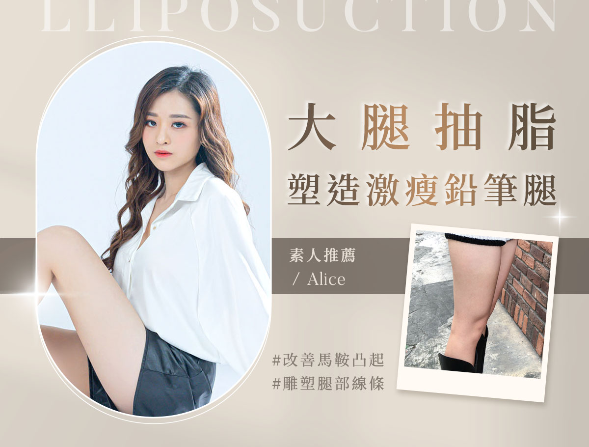 大腿抽脂_外bn_Alice