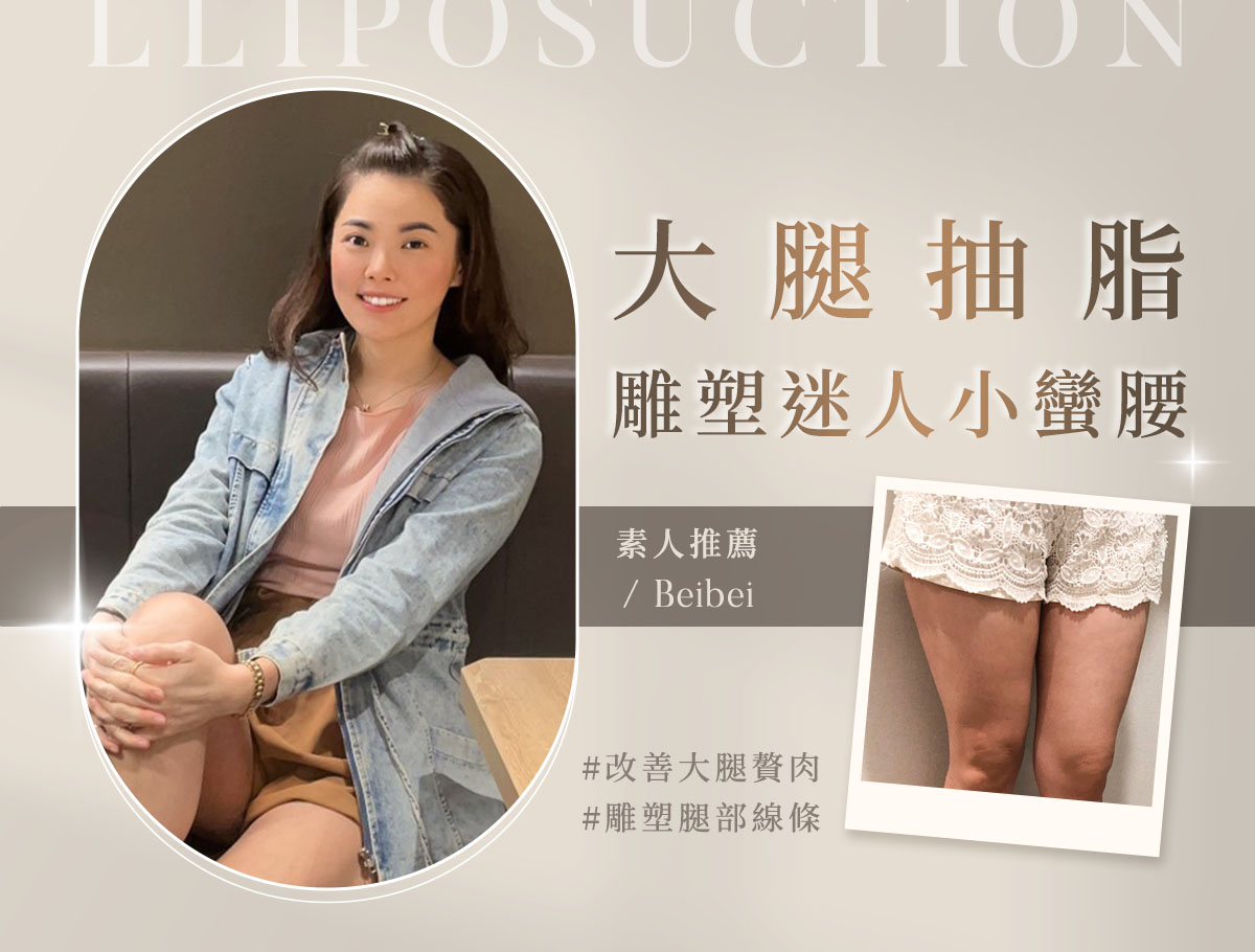 大腿抽脂_外bn_貝貝