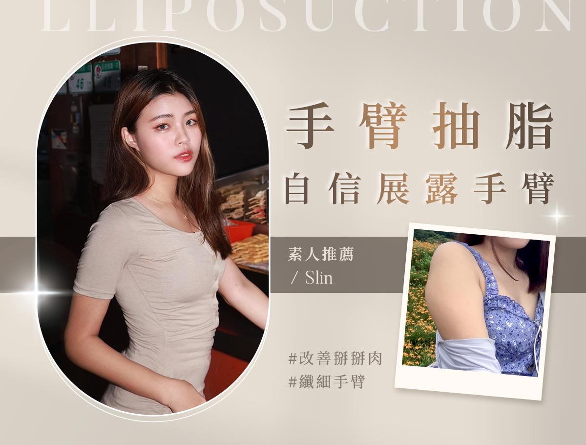 手臂抽脂_外bn_slin_01