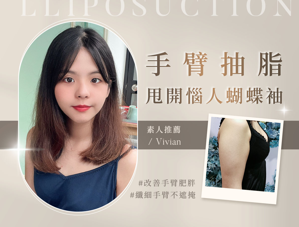 手臂抽脂_外bn_vivian