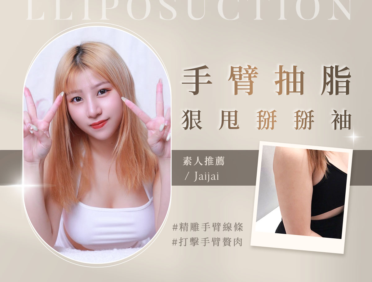 手臂抽脂_外bn_佳佳