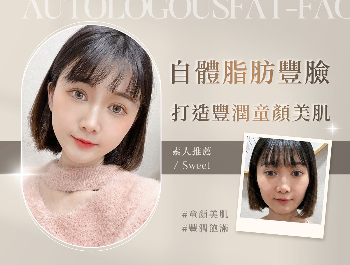 手術官網案例_外bn_甜天1