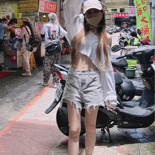 減重門診案例