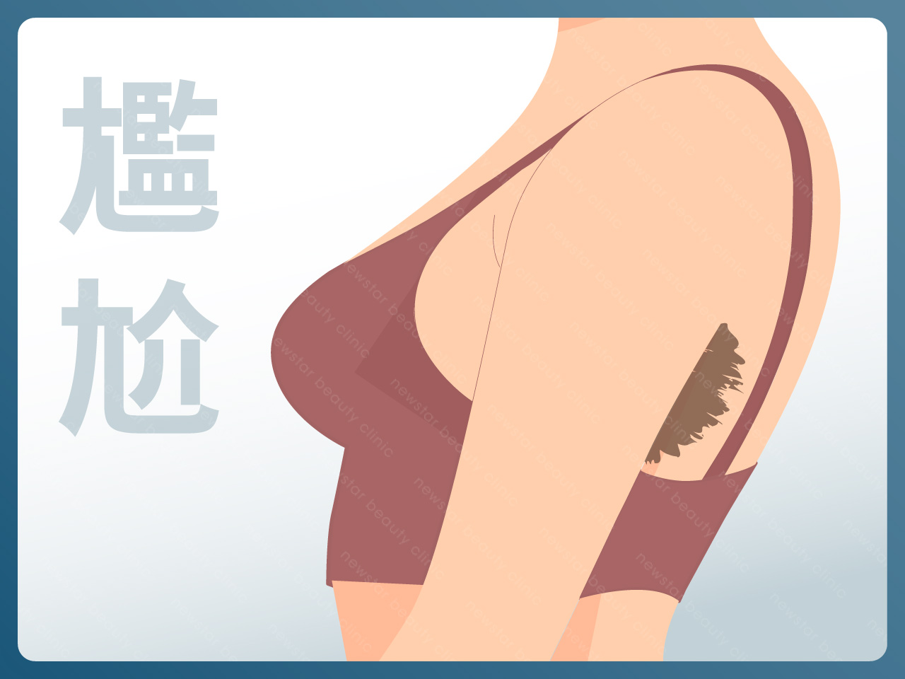 海神除毛_泳衣炸腋毛