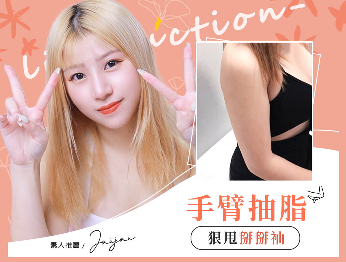 手臂抽脂手術_案例封面