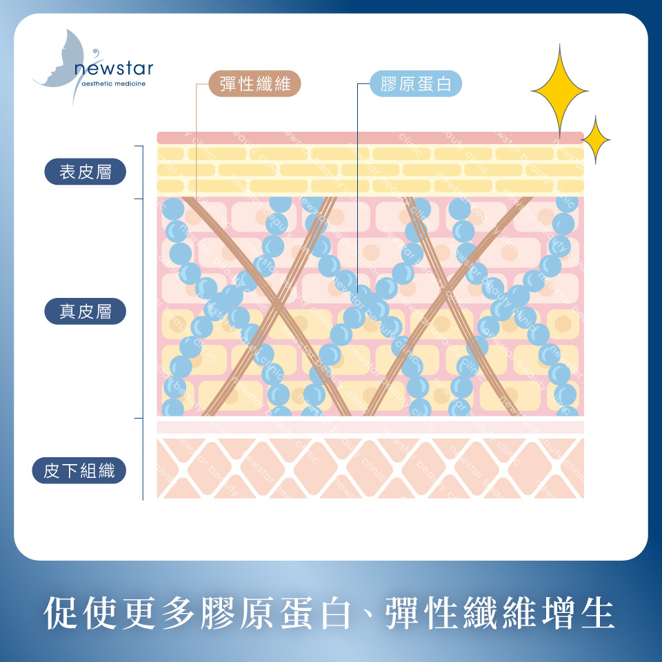 膠原蛋白熊貓針_緊緻拉提