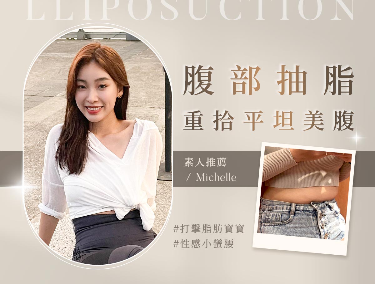 腹部抽脂_外bn_Michelle1