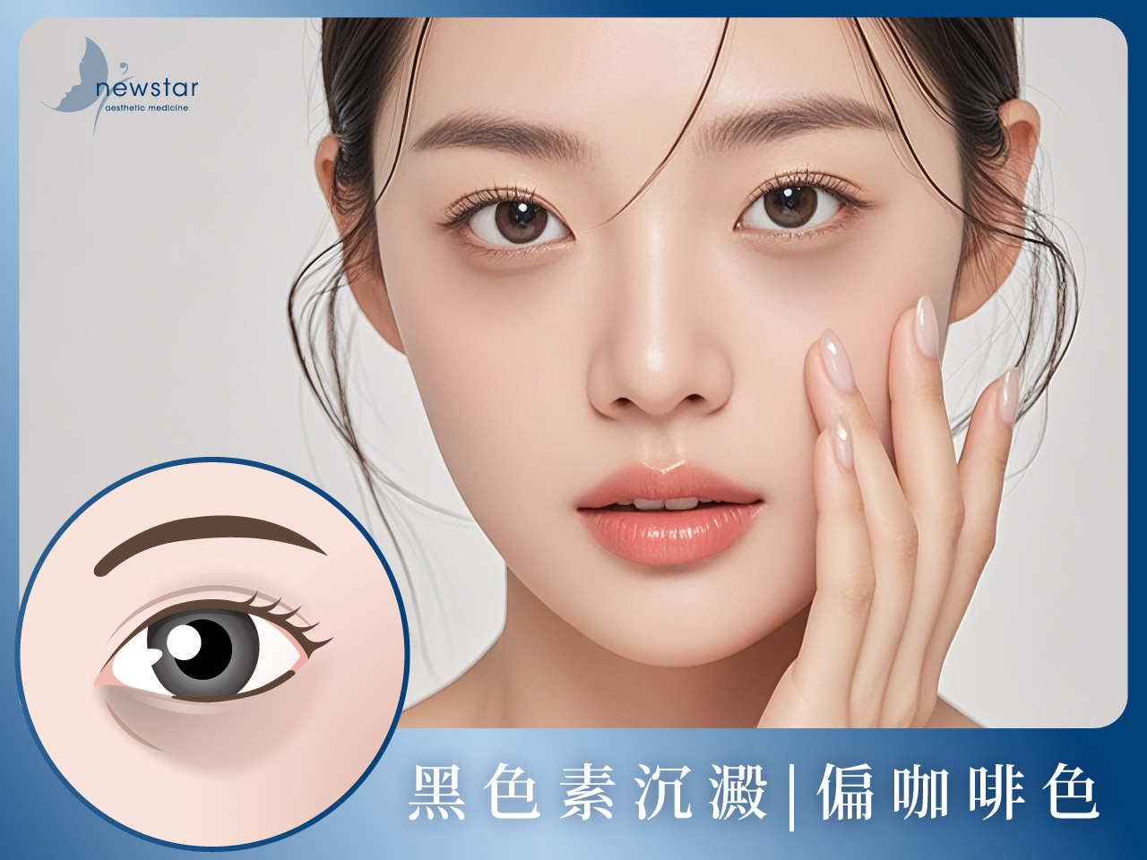 膠原蛋白熊貓針_色素型黑眼圈