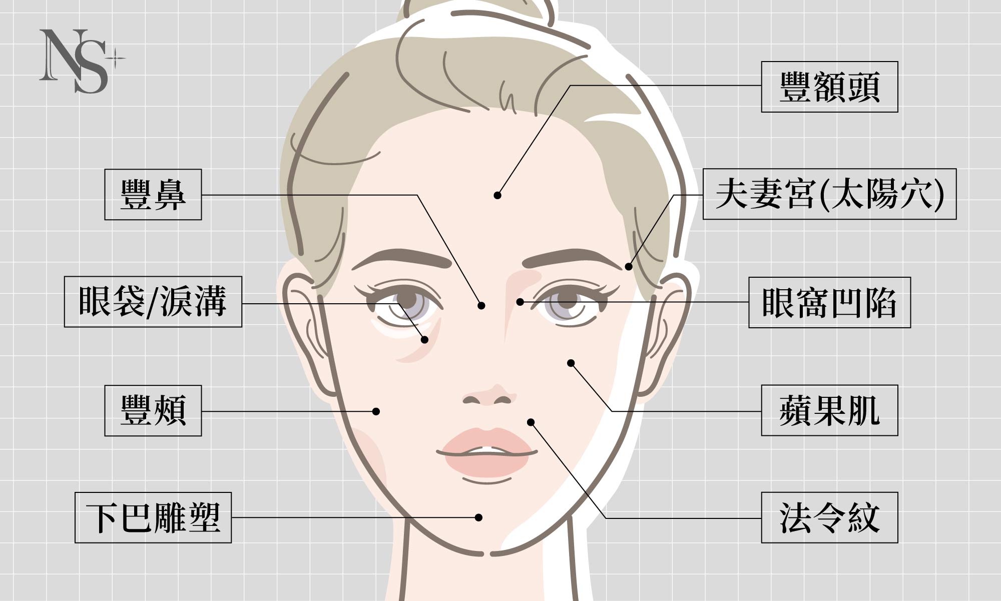 自體脂肪補臉｜適用部位