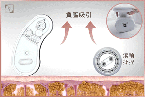 LPG體雕_作用方式
