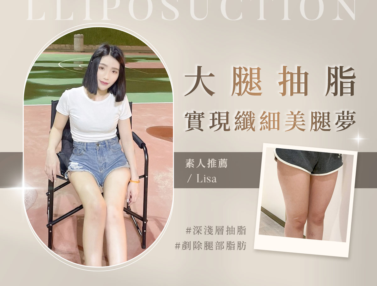 大腿抽脂_外bn_lisa