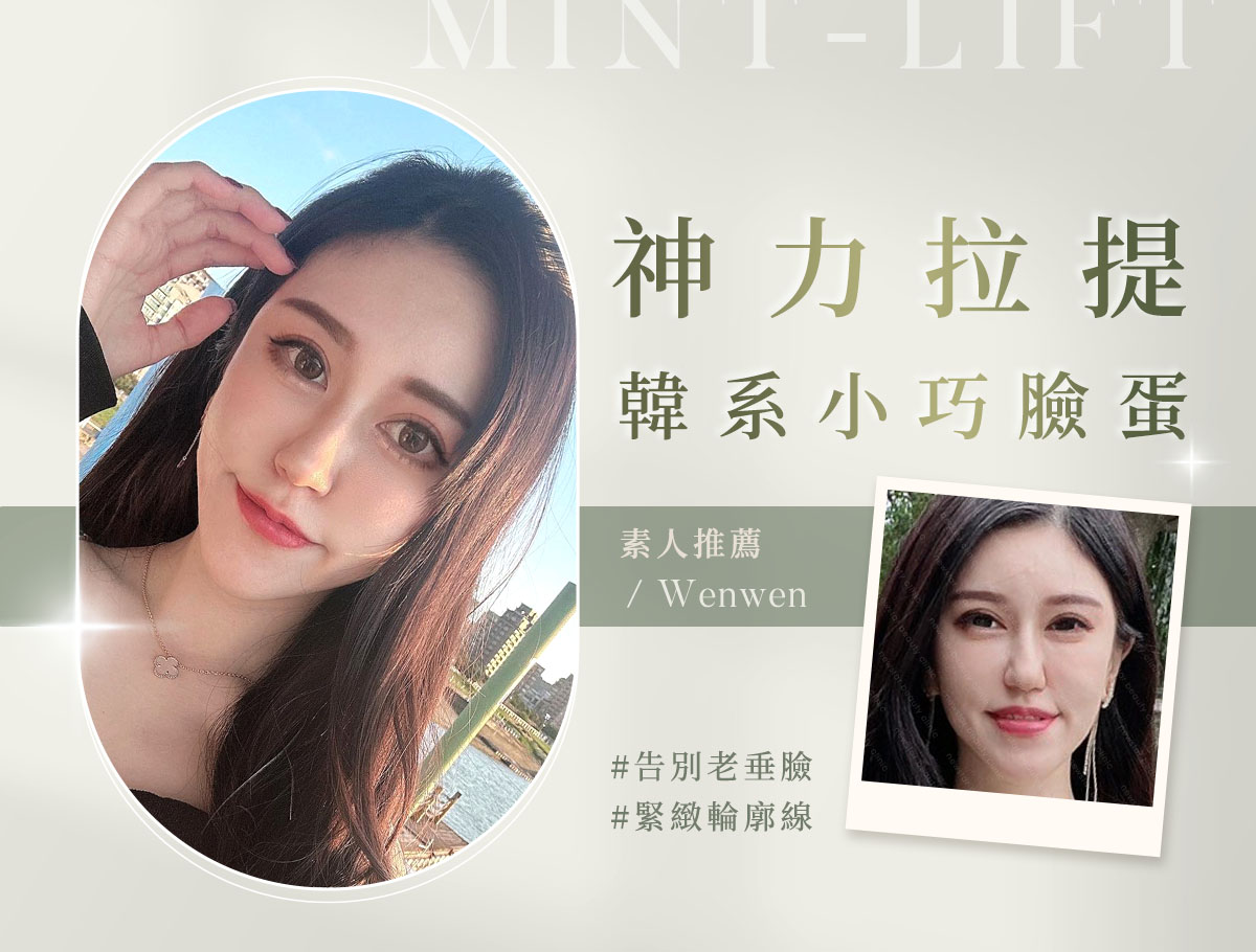微整官網案例_外bn_文文