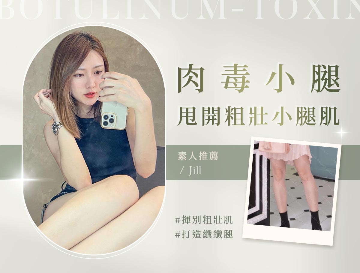微整官網案例_外bn_橘兒