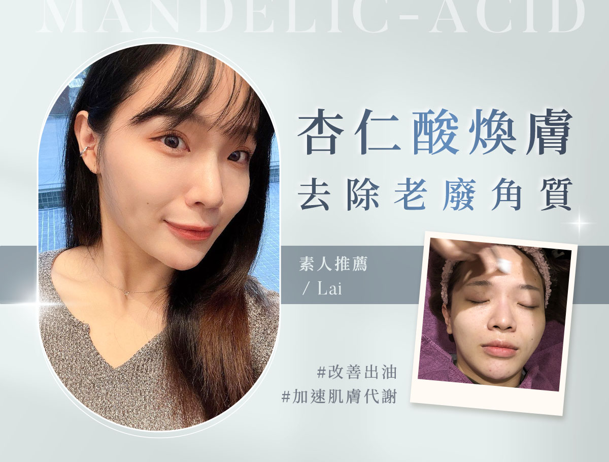 杏仁酸_瑞納_外bn