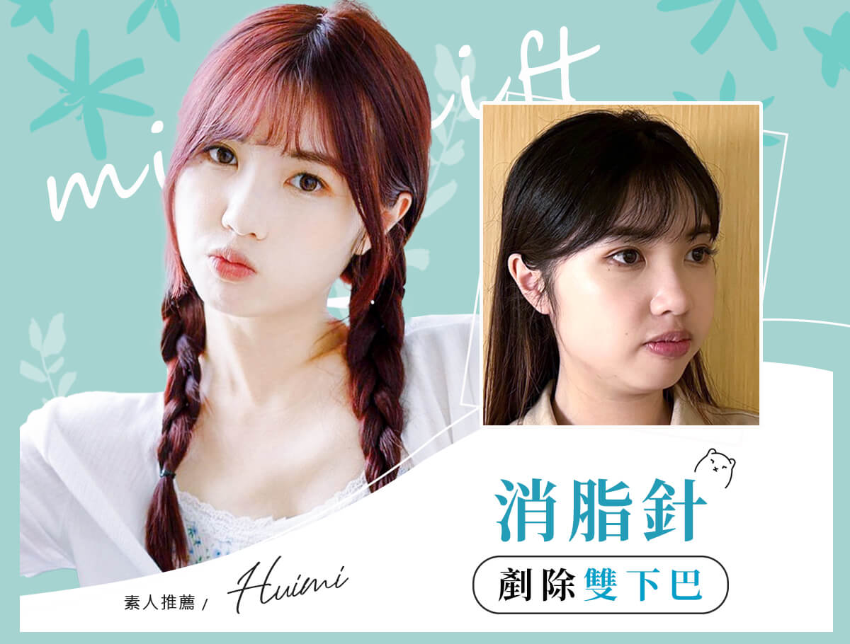 貝克脂消脂針_案例封面