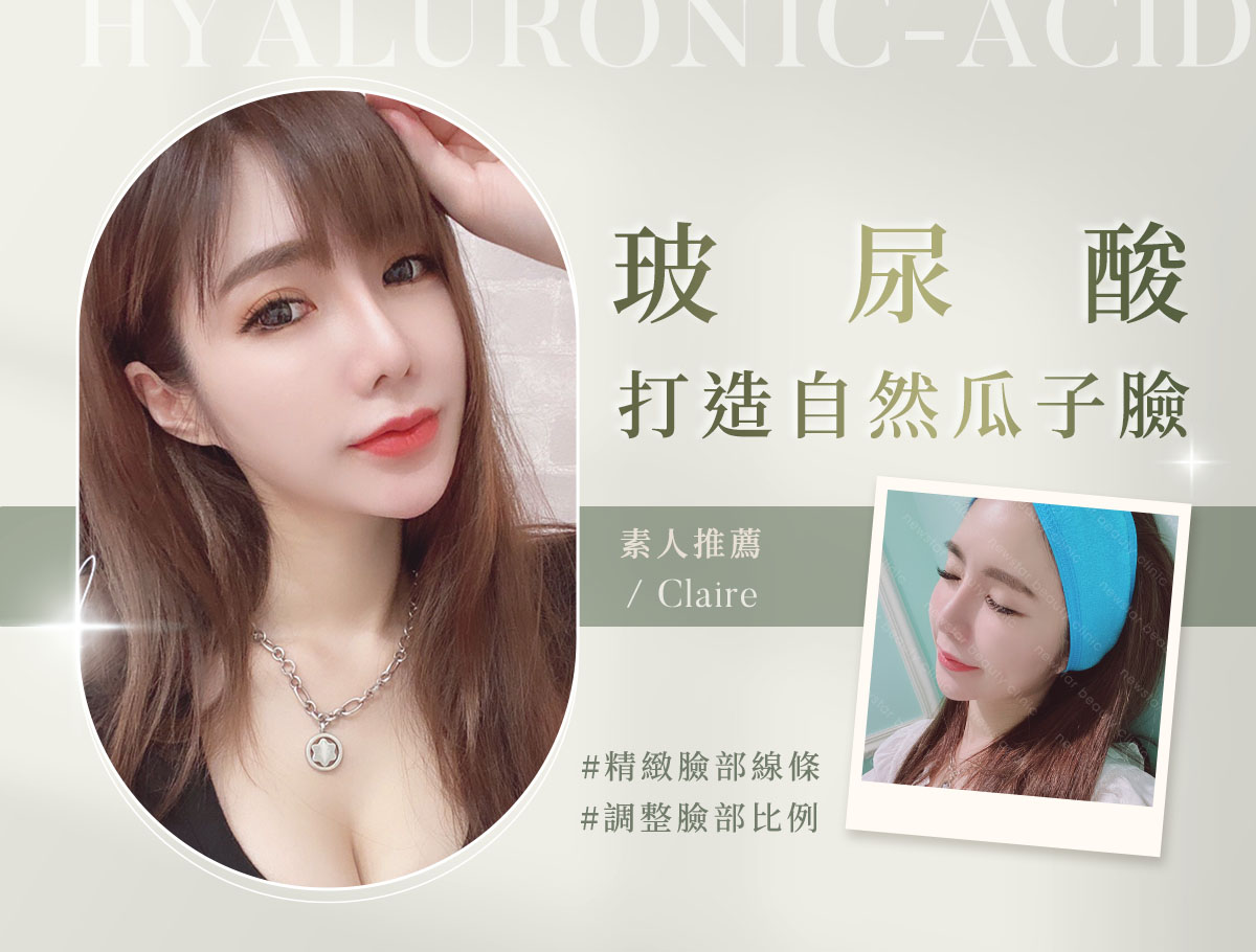 玻尿酸_微整官網案例(外BN)_claire