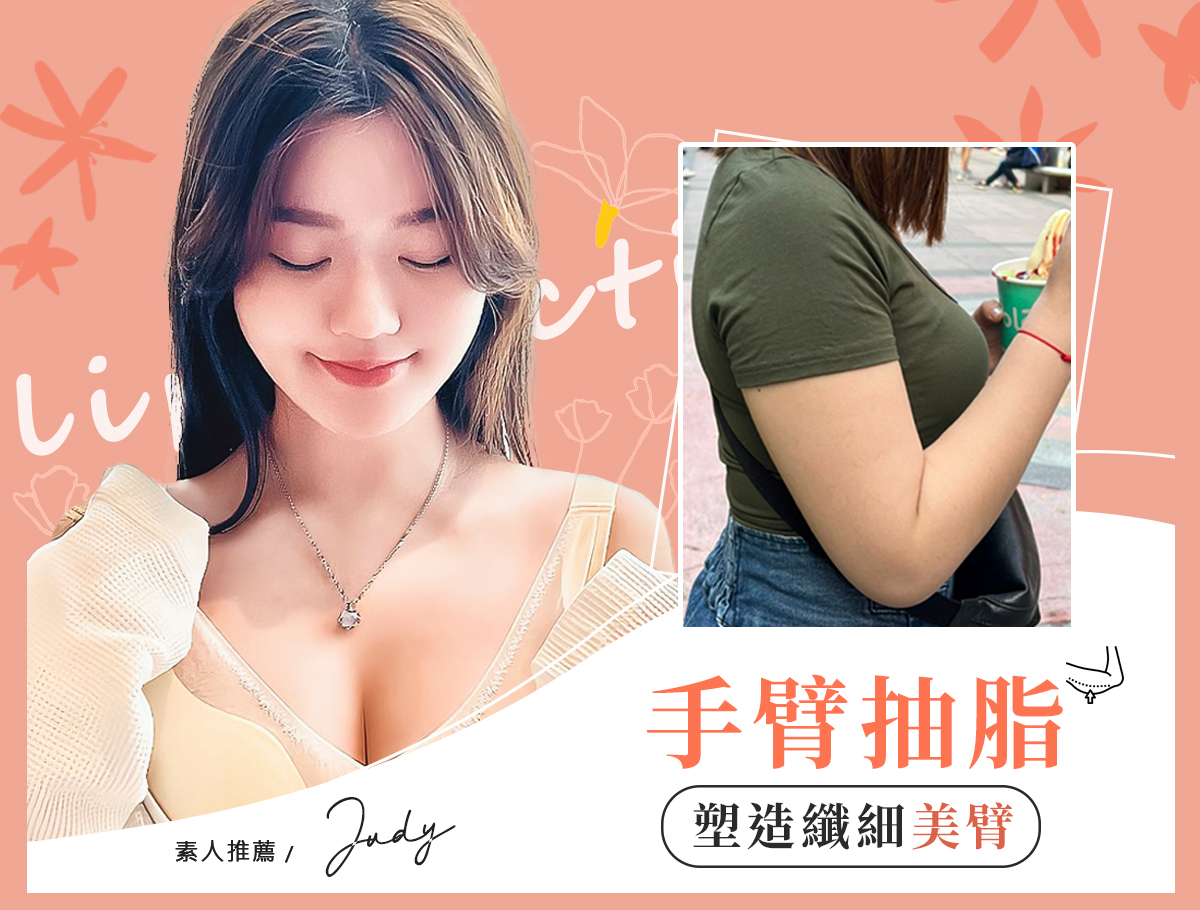 手臂環抽案例