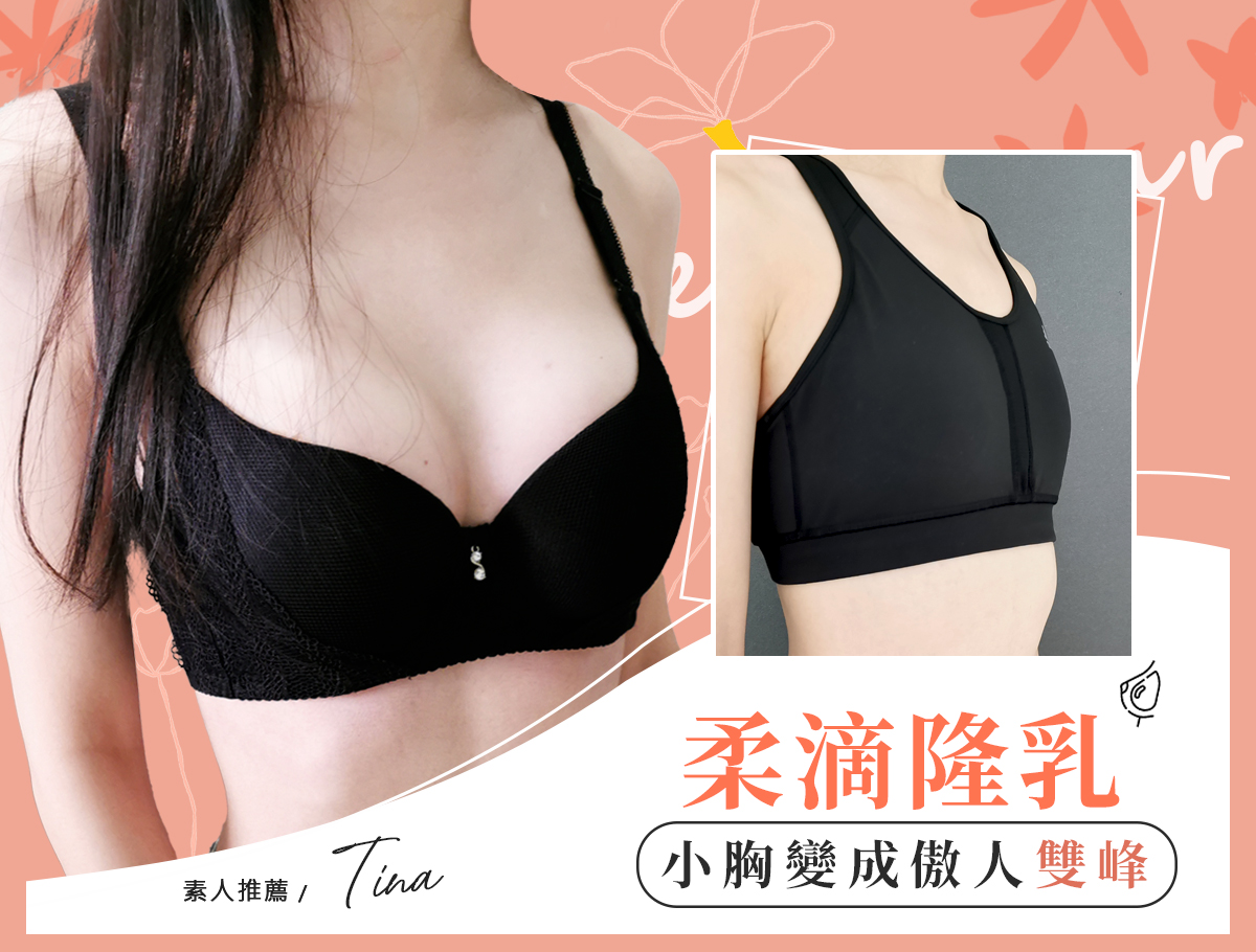 果凍隆乳_tina