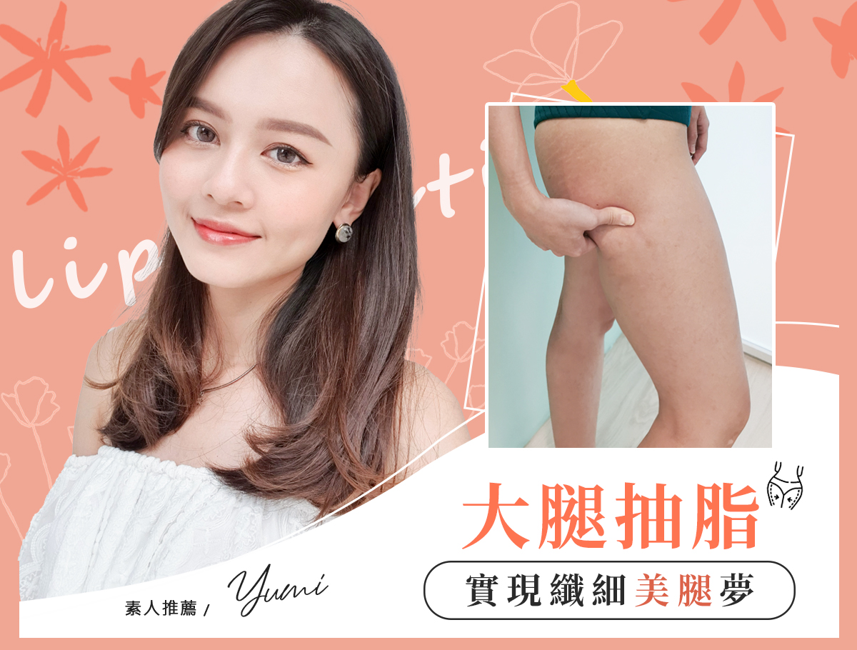 大腿環抽案例