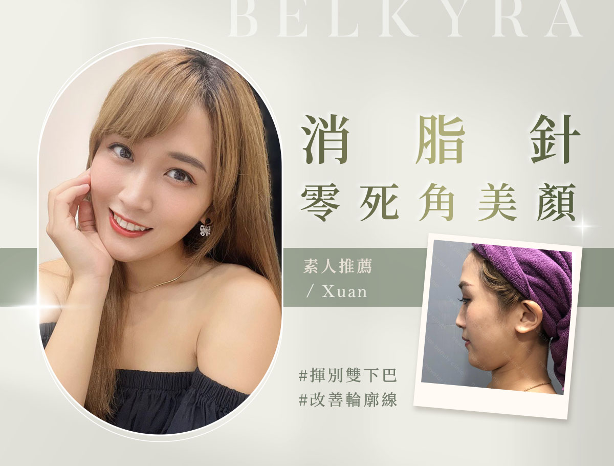 美療官網案例_外bn_璇璇(新版)