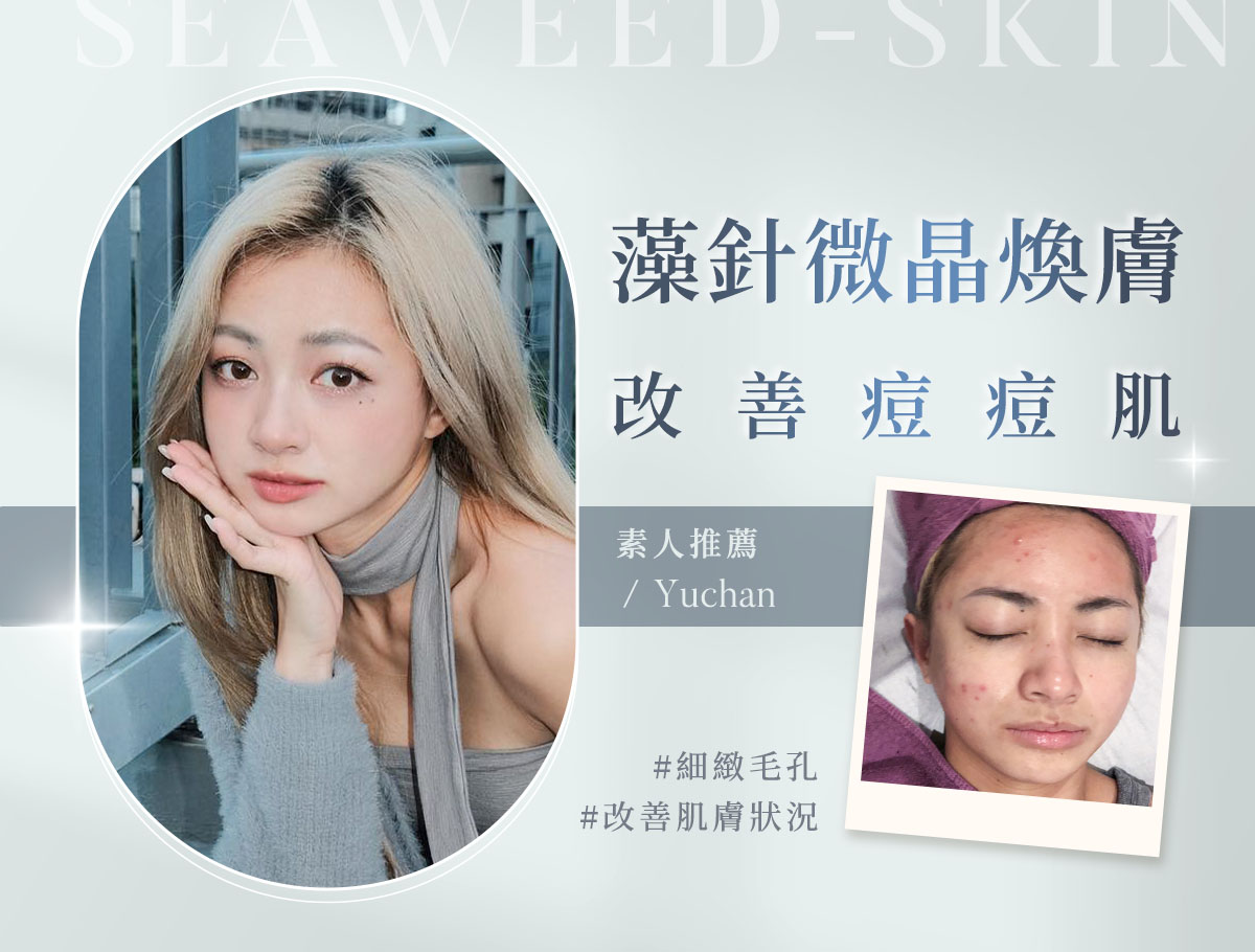 藻針微晶煥膚_外bn_羽珊