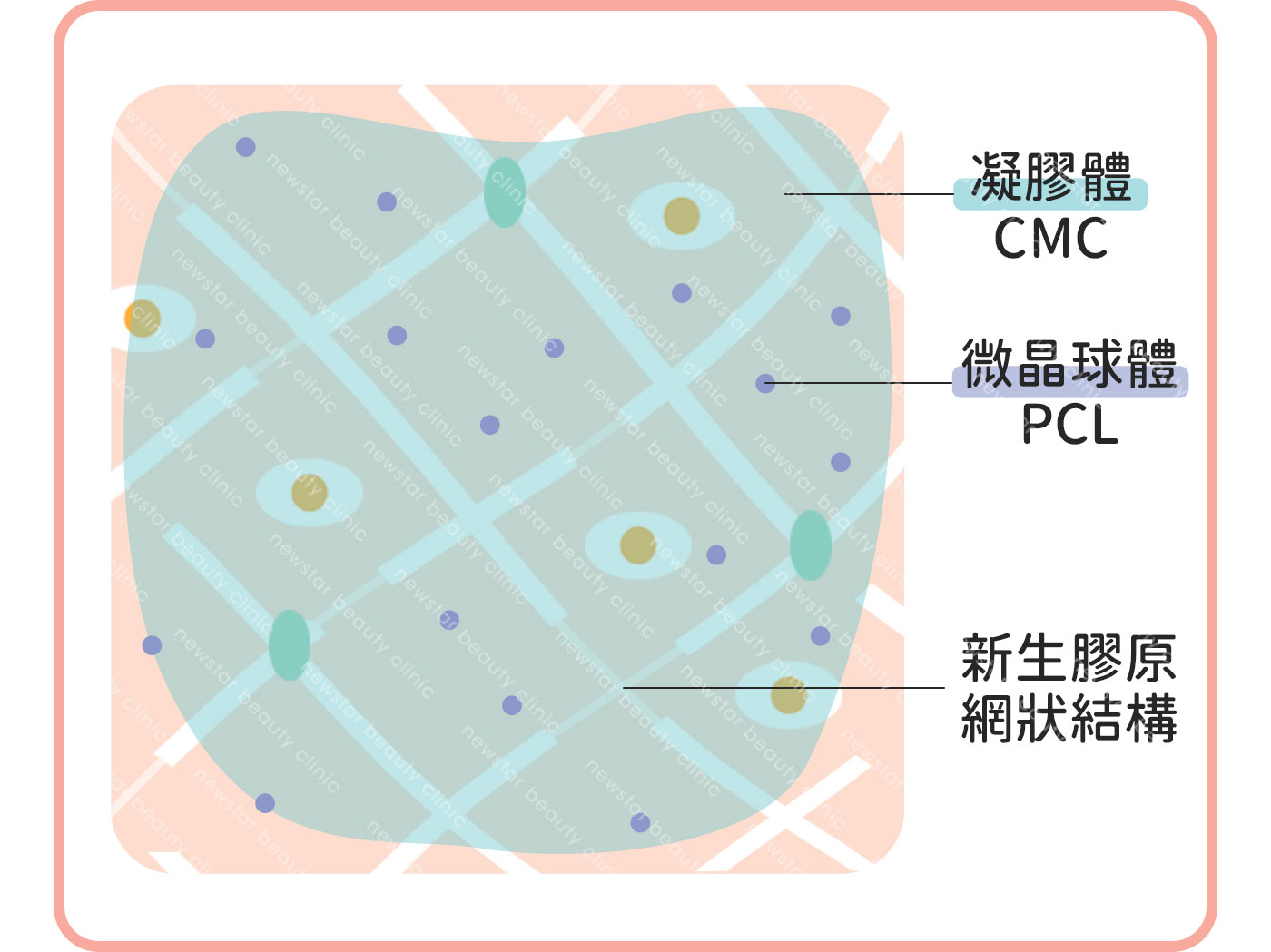 洢蓮絲少女針治療原理：微型晶球刺激形成膠原網狀結構