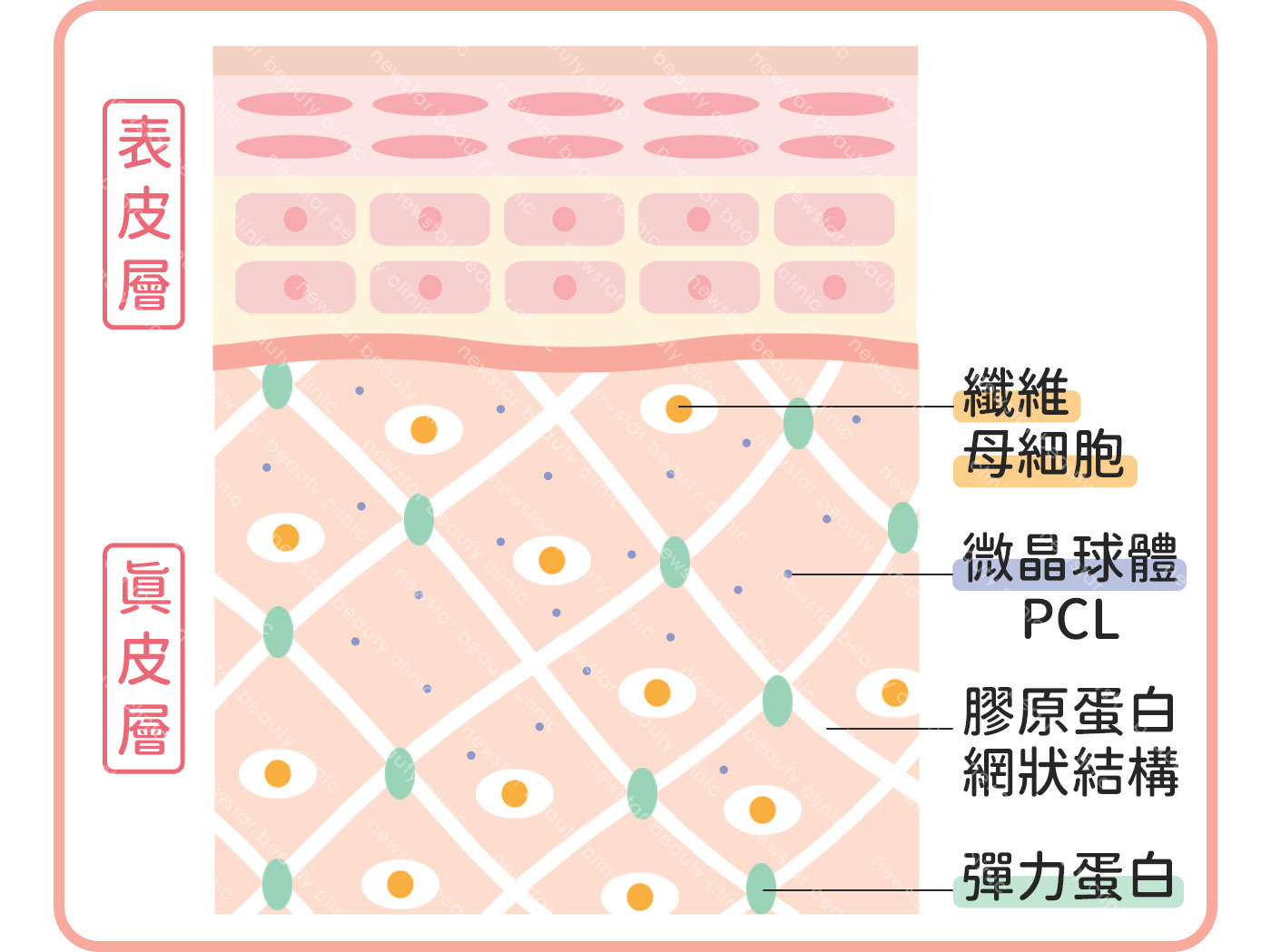 洢蓮絲少女針原理_凝膠體代謝完全，新生的膠原蛋白持續支撐其凹陷部位