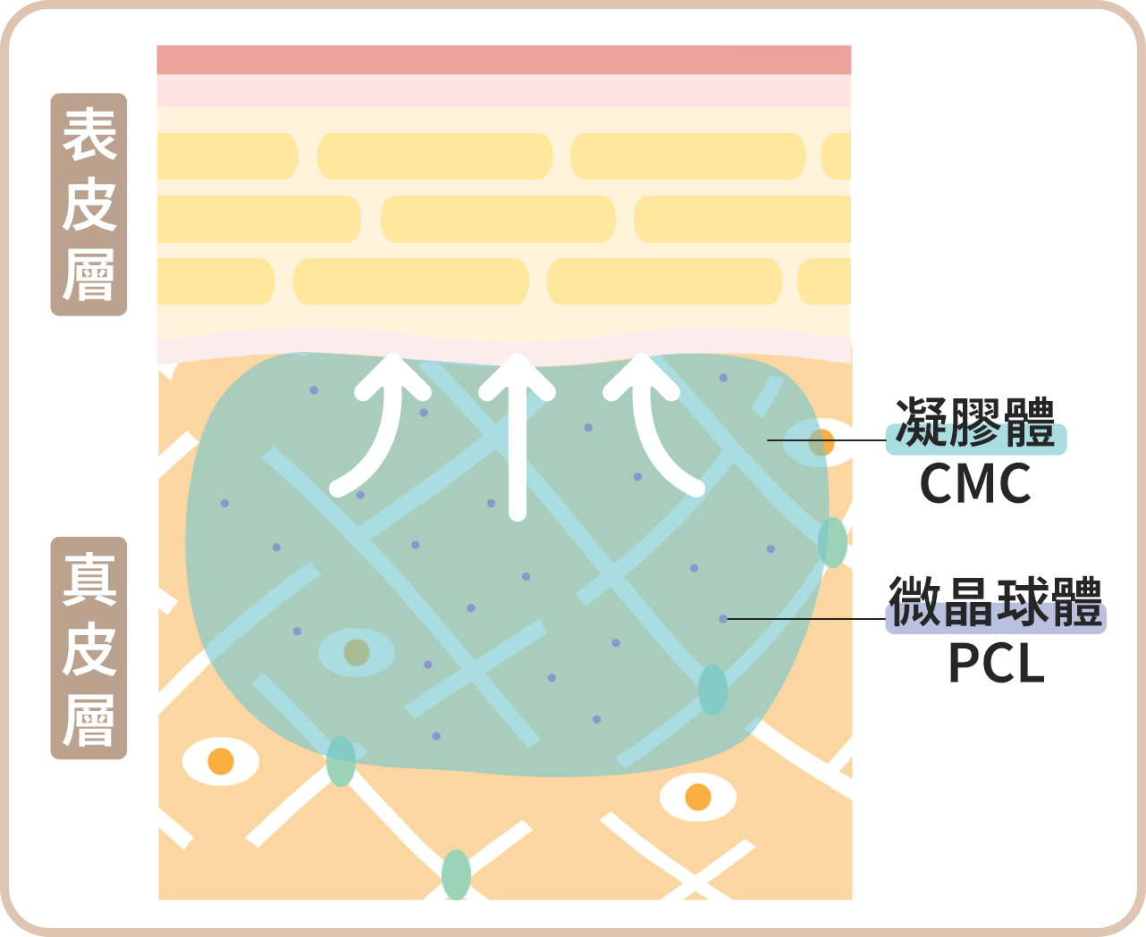 洢蓮絲注射原理_step.2.01