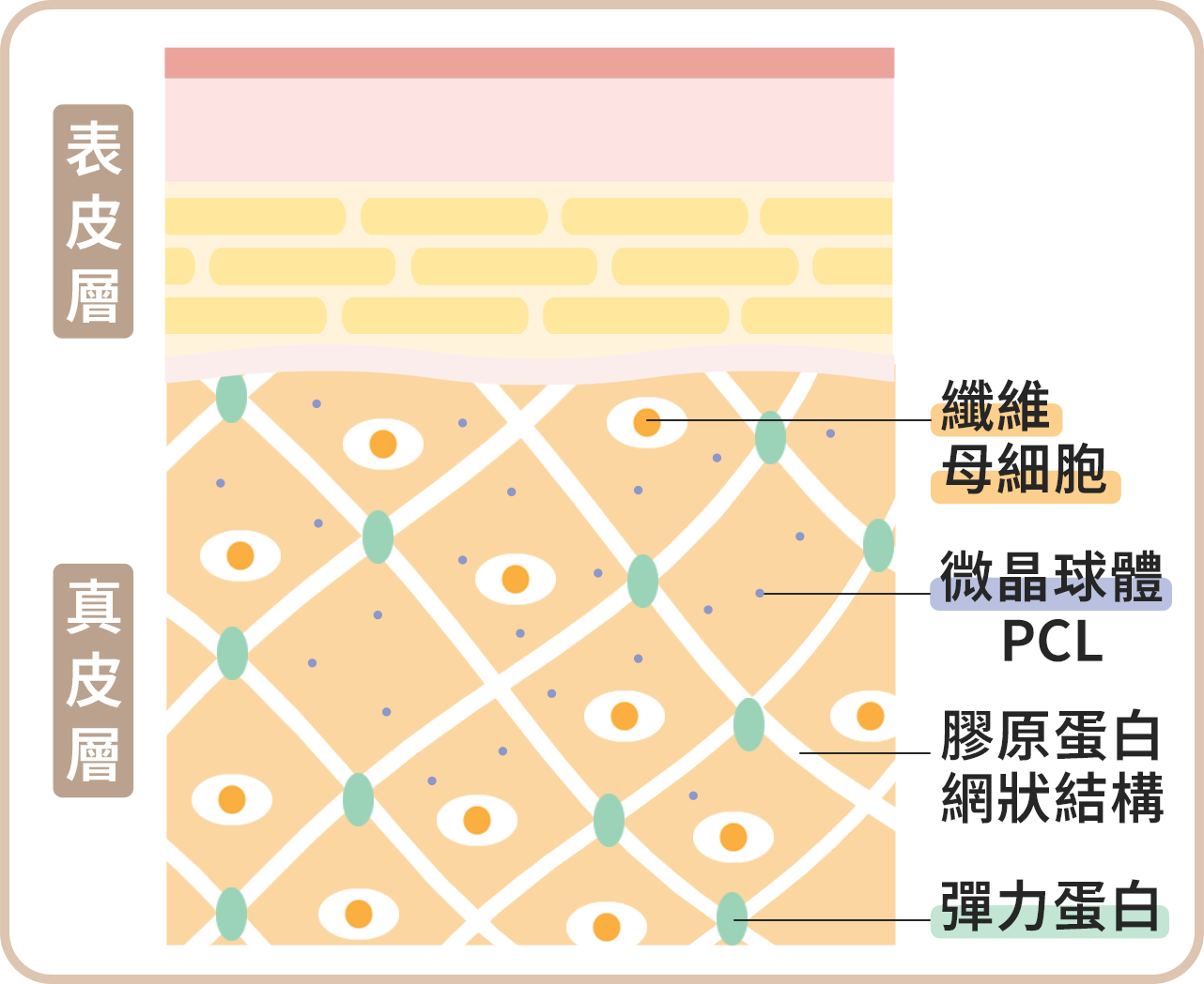 洢蓮絲注射原理_step.5