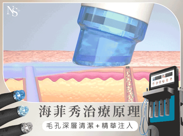 海菲秀原理
