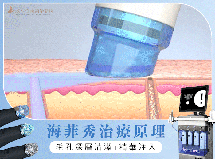 水飛梭_海菲秀原理