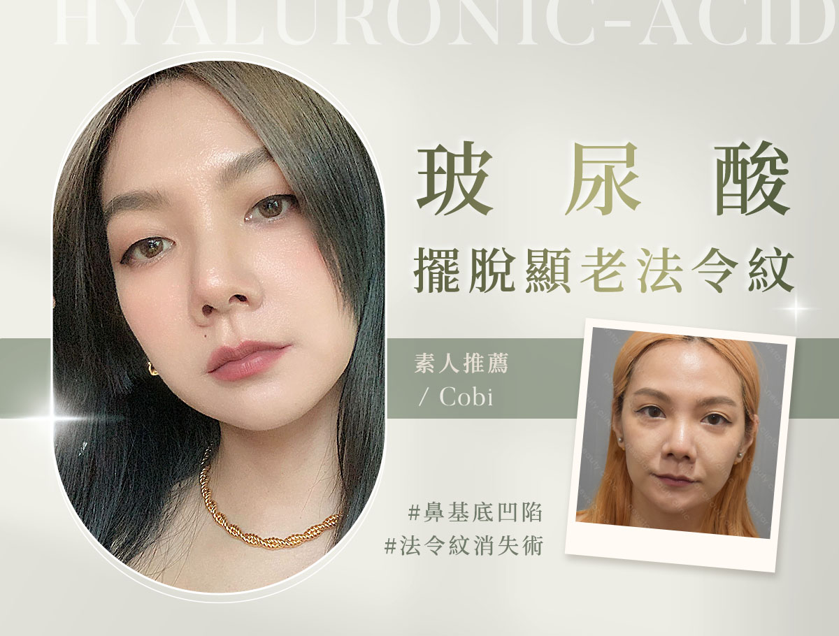 玻尿酸_微整官網案例(外BN)_可比