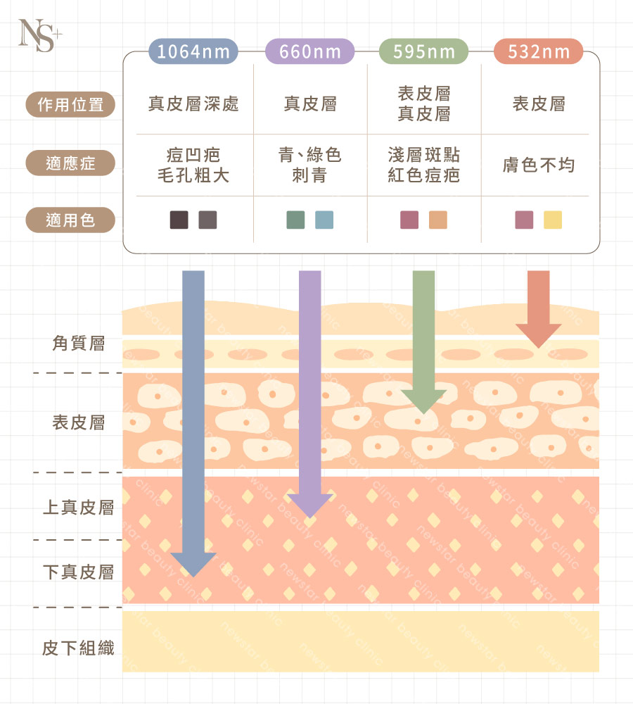 皮秒雷射_不同皮秒雷射波長對應的適應症