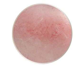 水飛梭海菲秀適用對象－乾燥敏感肌